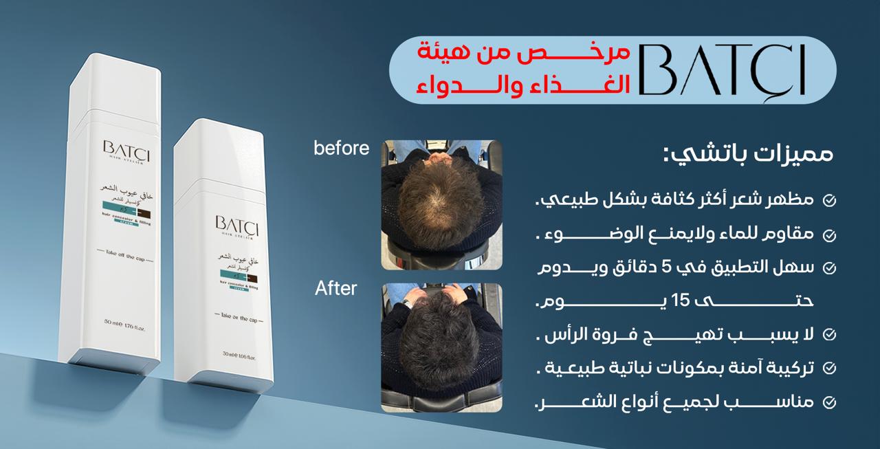 باتشي هير: حلول تجميلية غير جراحية تفرض حضورها في قطاع العناية بالشعر